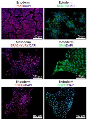 三胚层定向分化（PAX6:NESTIN+SOX17:FOXA2+SMA:BRADRYURY 所有指标均检测）：普通光学显微镜，中高倍镜，每个胚层各1张，共3张.jpg